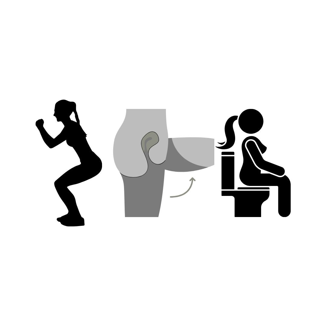 Illustration showing three positions for menstrual disc insertion: squatting, sitting on toilet, and lifting one leg