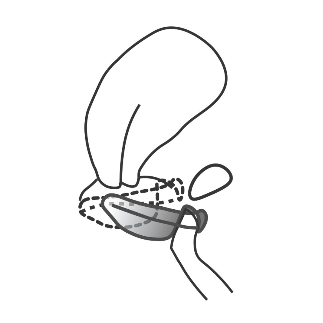 Illustration showing a menstrual disc being carefully removed while kept level and parallel to the floor to prevent spills